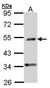 IHC-plus™ Polyclonal Rabbit anti-Human PDSS2 / DLP1 Antibody (aa88-351, IHC, WB)