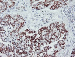 TP53 / p53 Antibody (clone OTI3A6)