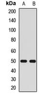 Polyclonal Rabbit anti-Human KCNJ4 / Kir2.3 Antibody (WB)