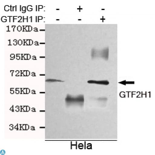 TFB1 / GTF2H1 Antibody