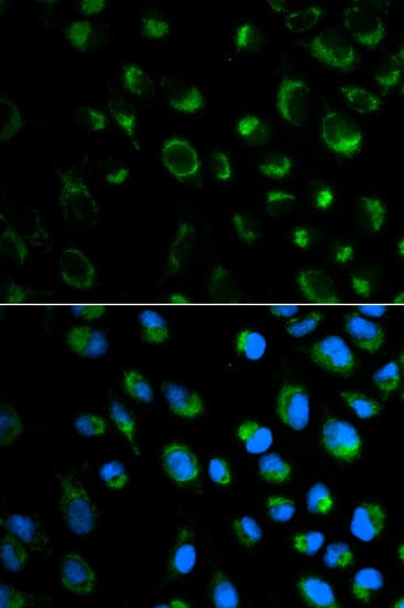 FXN / Frataxin Antibody