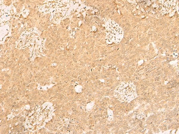 GSG1L Antibody