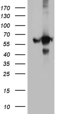 Monoclonal Mouse anti-Human GDI1 Antibody (clone OTI7F7, WB)