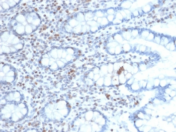 BMI1 / PCGF4 Antibody (clone BMI1/2689)