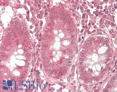 IHC-plus™ FZD6 / Frizzled 6 Antibody (aa116-165)