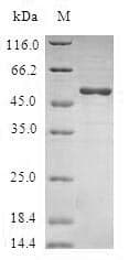 Human RALB Protein (Recombinant GST, N-terminus)