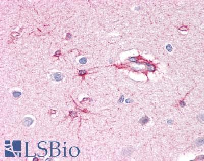 IHC-plus™ Polyclonal Rabbit anti-Human PAOX / PAO Antibody (aa467-496, IHC, WB)