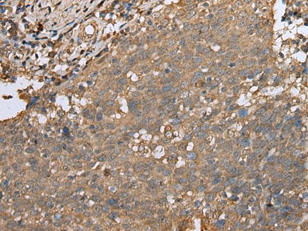 Polyclonal Rabbit anti-Human ALKBH8 Antibody (IHC, WB)