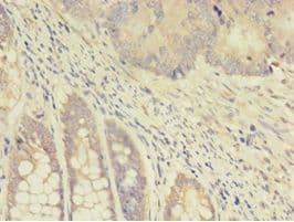 TK1 / TK / Thymidine Kinase Antibody (aa2-234)