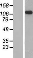 ADGRG2 / GPR64 Protein (Over-Expression Lysate Myc-DDK (Flag))