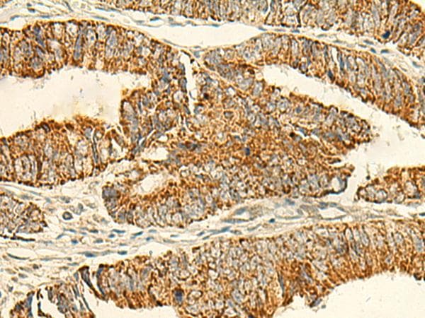 IFT27 / RABL4 Antibody