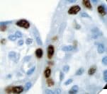 Monoclonal Mouse anti-Human CDKN1C / p57 Kip2 Antibody (clone Kp10, Ready-to-Use, IHC)