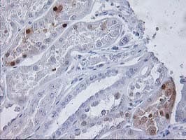 PGAM2 Antibody (clone OTI1C11, Carrier-free)