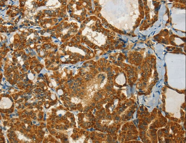 Polyclonal Rabbit anti-Human C15orf2 Antibody (IHC)