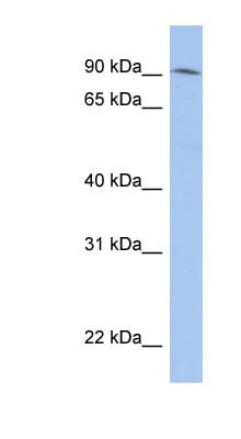 NRROS / LRRC33 Antibody (aa179-228, Biotin)