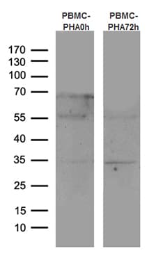 CTLA4 / CD152 Antibody (clone OTI8F1, Carrier-free)