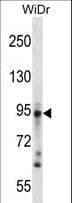 Polyclonal Rabbit anti-Human DSG3 / Desmoglein 3 Antibody (aa8-36, WB)