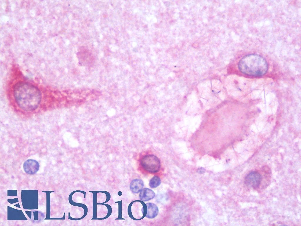 IHC-plus™ Polyclonal Rabbit anti-Human PSPLA1 / Phospholipase A1 Antibody (IHC, IF, WB)