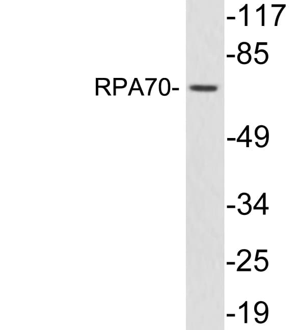 Polyclonal Rabbit anti-Human RPA70 / RPA1 Antibody (aa323-372, WB)