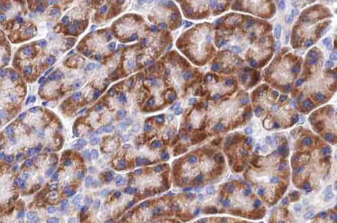 Polyclonal Rabbit anti-Human LRAT Antibody (IHC, IF, WB)