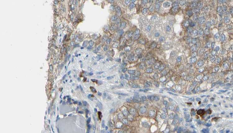 CDCA3 Antibody