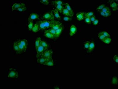 PathPlus™ Polyclonal Rabbit anti-Human APOE / Apolipoprotein E Antibody (IHC, IF)