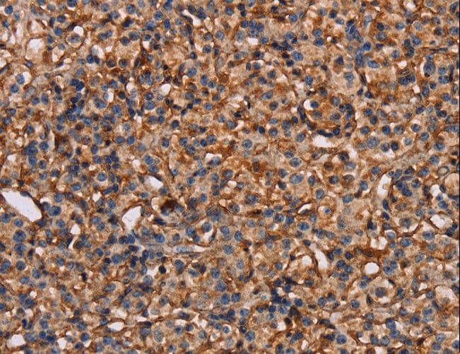 PLXNA1 / Plexin A1 Antibody