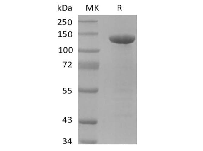 Human APP / Beta Amyloid Precursor Protein (Recombinant Fc, C-terminus)