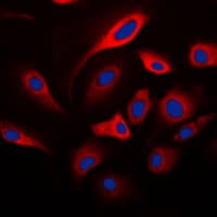 HSD17B10 / HADH2 Antibody (Internal)