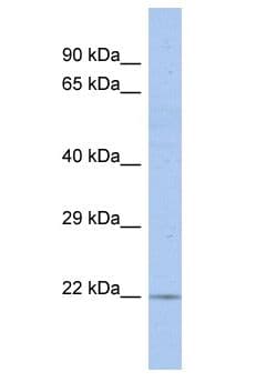 RGS17 / RGSZ2 Antibody (aa160-209)
