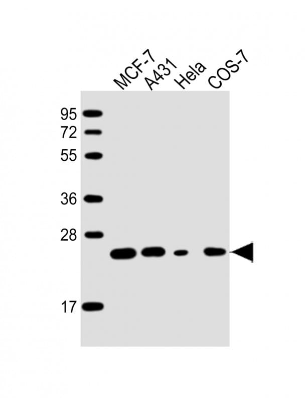 RAB21 Antibody (clone 1701CT536.68.39)