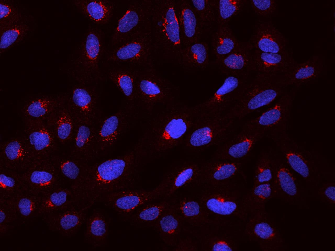 PDXDC1 Antibody