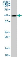 IHC-plus™ TUBB2A / Tubulin Beta 2A Antibody (clone 2B2)
