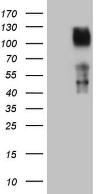 TNFRSF14 / CD270 / HVEM Antibody (aa39-283, clone OTI1A7)