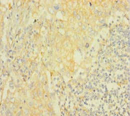 AKT2 Antibody (aa1-481)