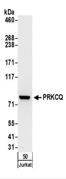 PRKCQ / PKC-Theta Antibody (aa656-706)