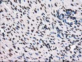 KIAA0153 / TTLL12 Antibody (clone OTI4B2)