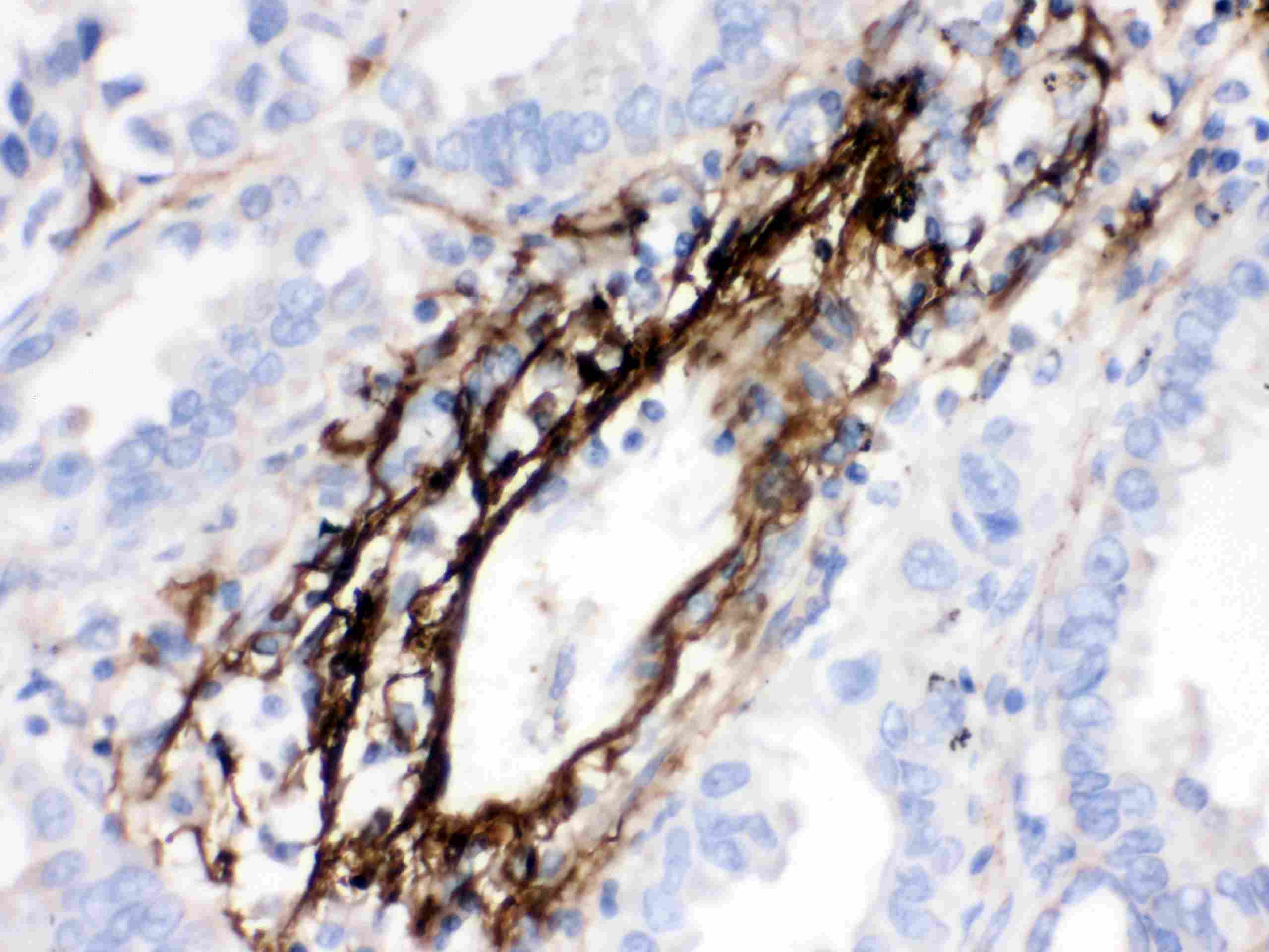 MGP / Matrix Gla-Protein Antibody