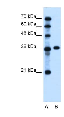 Polyclonal Rabbit anti-Human PTCH1 / Patched 1 Antibody (aa58-107, IHC, WB)
