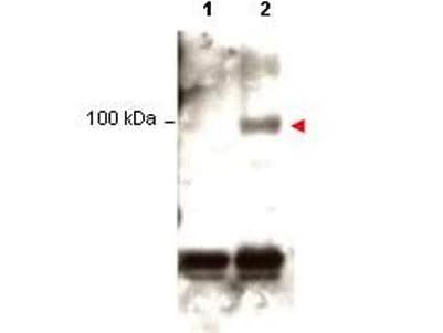 STAT1 Antibody (phospho-Tyr701)