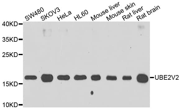 MMS2 / UBE2V2 Antibody