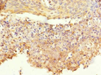 CORO1C Antibody