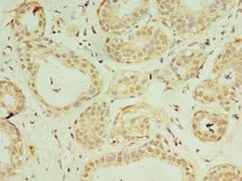 Polyclonal Rabbit anti-Human IL37 Antibody (aa1-218, IHC)