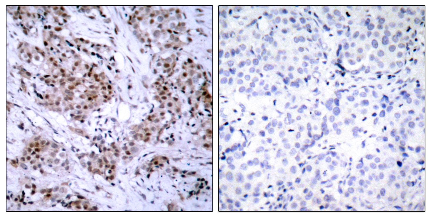 ER Alpha / Estrogen Receptor Antibody (p167)