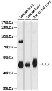 CKB / Creatine Kinase BB Antibody