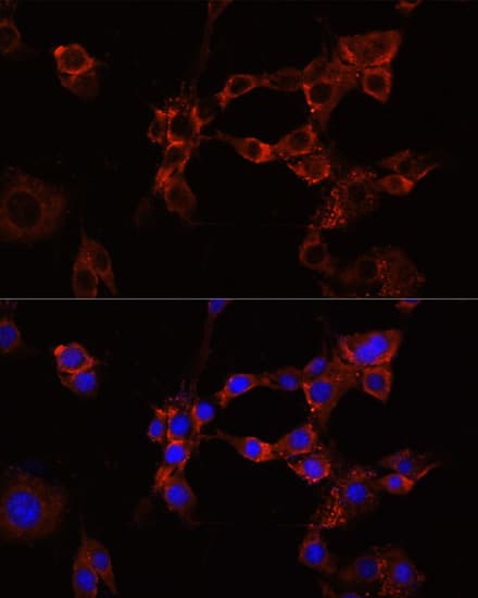 IGF1R / IGF1 Receptor Antibody