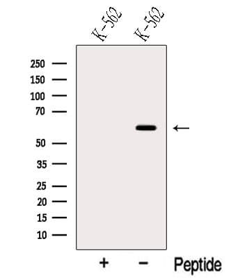 Polyclonal Rabbit anti-Human NOP58 / NOP5 Antibody (WB)