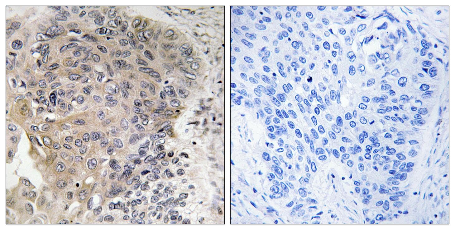 Polyclonal Rabbit anti-Human AGBL3 Antibody (IHC)