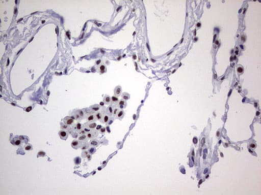 Monoclonal Mouse anti-Human PPP1R8 / Rnase E Antibody (clone OTI4E5, aa1-225, IHC, WB)