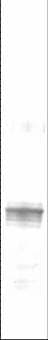 IHC-plus™ TGFB4 / LEFTY2 Antibody (clone 7C5G1H6H10)
